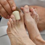 Podología geriátrica en Mollet del Vallés